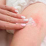 A person applying cream on their skin